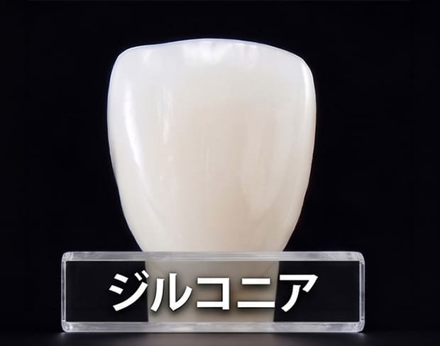 ジルコニアセラミック