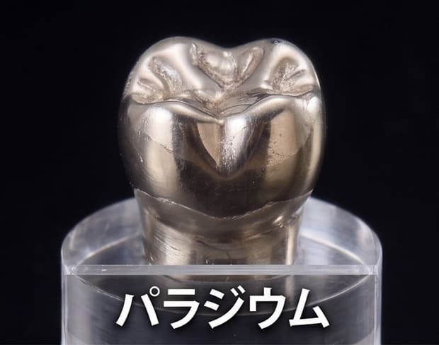 パラジウム