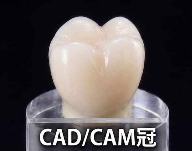 CADCAM